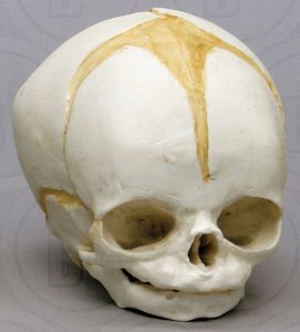 Schedel foetus 32 weken