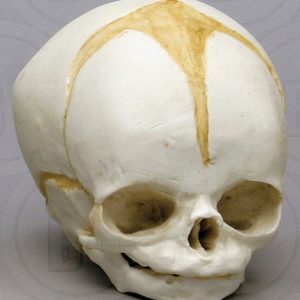 Schedel foetus 32 weken