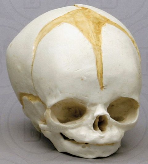 Schedel foetus 32 weken