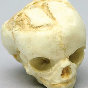 Foetus schedel 17 weken
