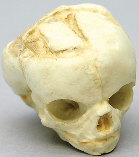 Foetus schedel 17 weken