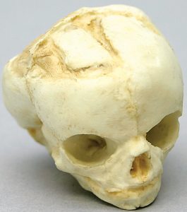 Foetus schedel 17 weken