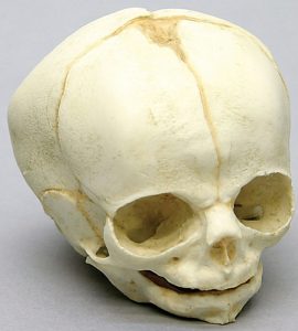 Foetus schedel 30 weken
