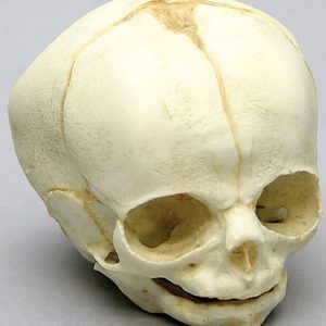 Foetus schedel 30 weken