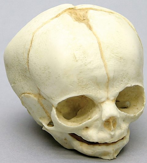 Foetus schedel 30 weken