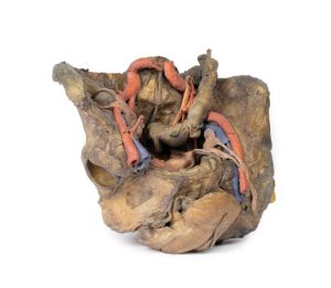 Bekken, diepe dissectie, 3D Print