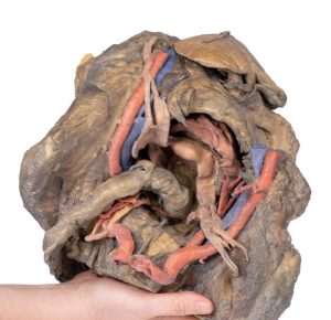 Bekken, diepe dissectie, 3D Print