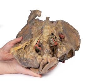 Bekken, diepe dissectie, 3D Print