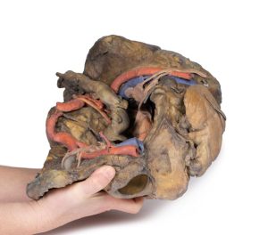 Bekken, diepe dissectie, 3D Print