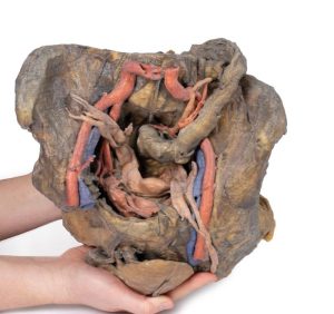 Bekken, diepe dissectie, 3D Print
