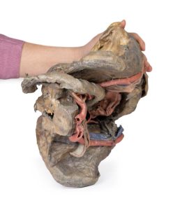 Bekken, diepe dissectie, 3D Print