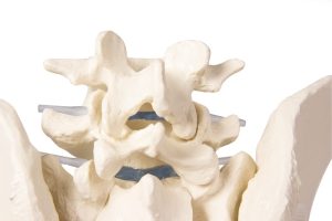 Bekkenskelet Model Man met Uitneembaar Sacrum (Heiligbeen)