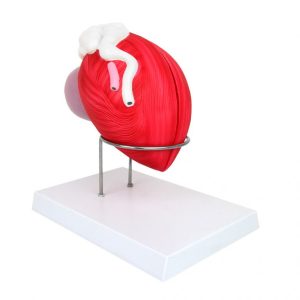 Mannelijke Blaas Model