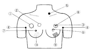 Borstkanker Palpatie Model