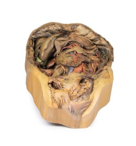 Buik met Liesbreuk, 3D Print