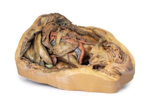 Buik met Liesbreuk, 3D Print