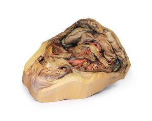 Buik met Liesbreuk, 3D Print