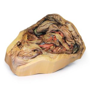 Buik met Liesbreuk, 3D Print