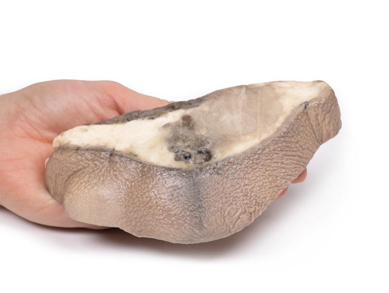 Carcinoom in de Borst, 3D Print