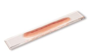 Chirurgische Wond Model