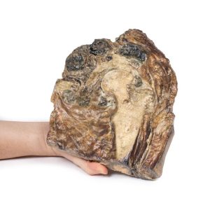 Chondrosarcoom in Dijbeen en Darmbeen, 3D Print