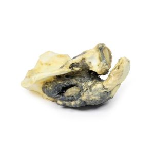 Chondrosarcoom in Schouderblad, 3D Print
