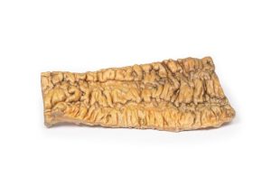 Colitis Ulcerosa, 3D Print