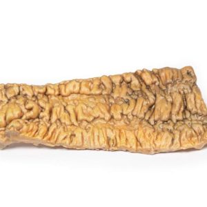 Colitis Ulcerosa, 3D Print