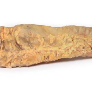 Colitis Ulcerosa, 3D Print