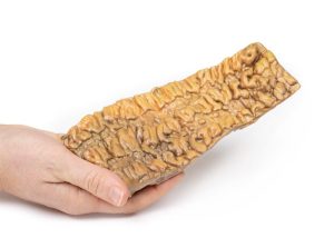 Colitis Ulcerosa, 3D Print