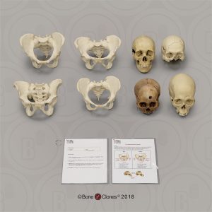 Collectie Forensische Antropologie