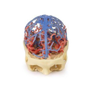 Craniale arteriële & veneuze circulatie, 3Dprint