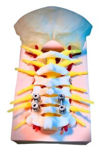 Craniocervicale Overgang Trainingsmodel