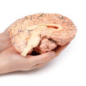 Craniofaryngioom, 3D Print