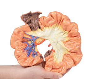 Darm - deel van het ilium, 3D Print