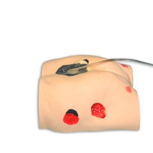 Decubitus (Ulcus) model