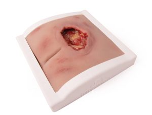 Decubitus Wond Model in houder, gereinigd