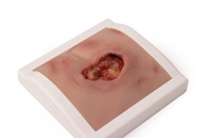 Decubitus Wond Model in houder, gereinigd