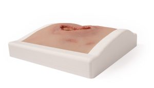 Decubitus Wond Model in houder, gereinigd