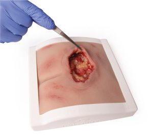 Decubitus Wond Model in houder, gereinigd