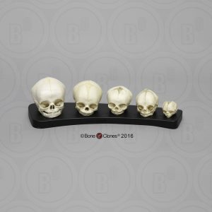 Modellenset Schedels Foetus, 5-delig