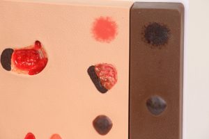 Doorligwonden Model