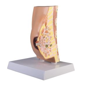 Doorsnede Borst Model met Ziektes