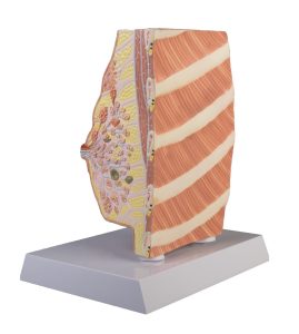 Doorsnede Borst Model met Ziektes