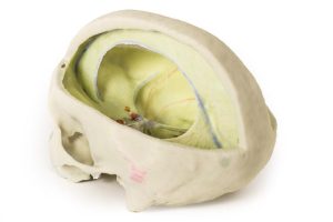 Durale Schedel, 3D Print