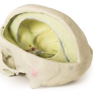 Durale Schedel, 3D Print