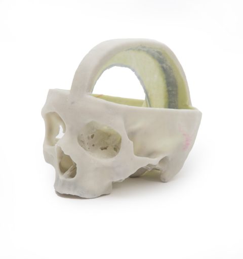 Durale Schedel, 3D Print