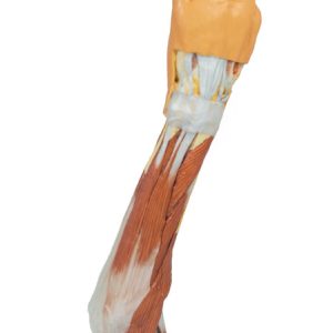 Elleboog, Onderarm & Hand, 3D Print