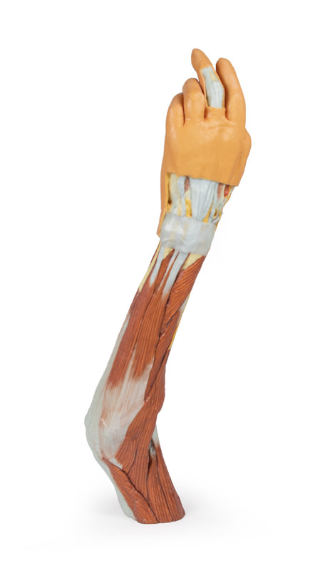 Elleboog, Onderarm & Hand, 3D Print