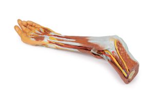 Elleboog, Onderarm & Hand, 3D Print